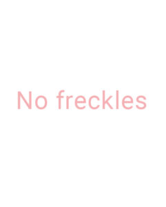 No freckles