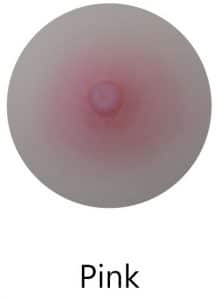 Pink areola color