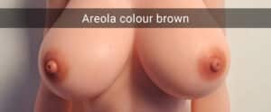 Brown areolas