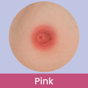 Areolas color pink